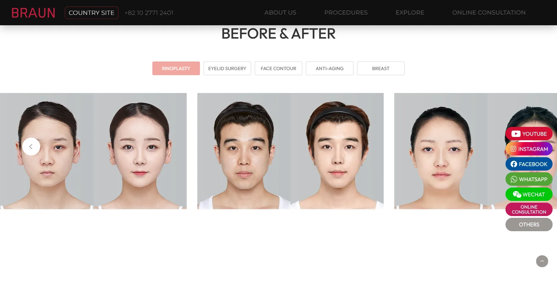 Braun 的 BEFORE & AFTER 區，依療程分頁的前後對照照片，右側常駐六個聯絡管道